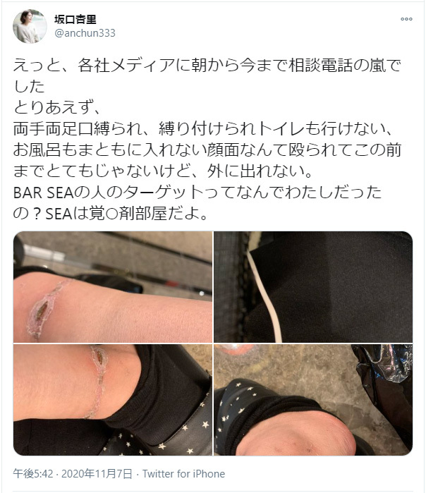 被黑道綑绑殴打！？坂口杏里流出很锵的影片！