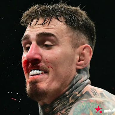 大发体育-UFC冠军汤姆将继续进行双眼手术，大发助力你的致富之路！